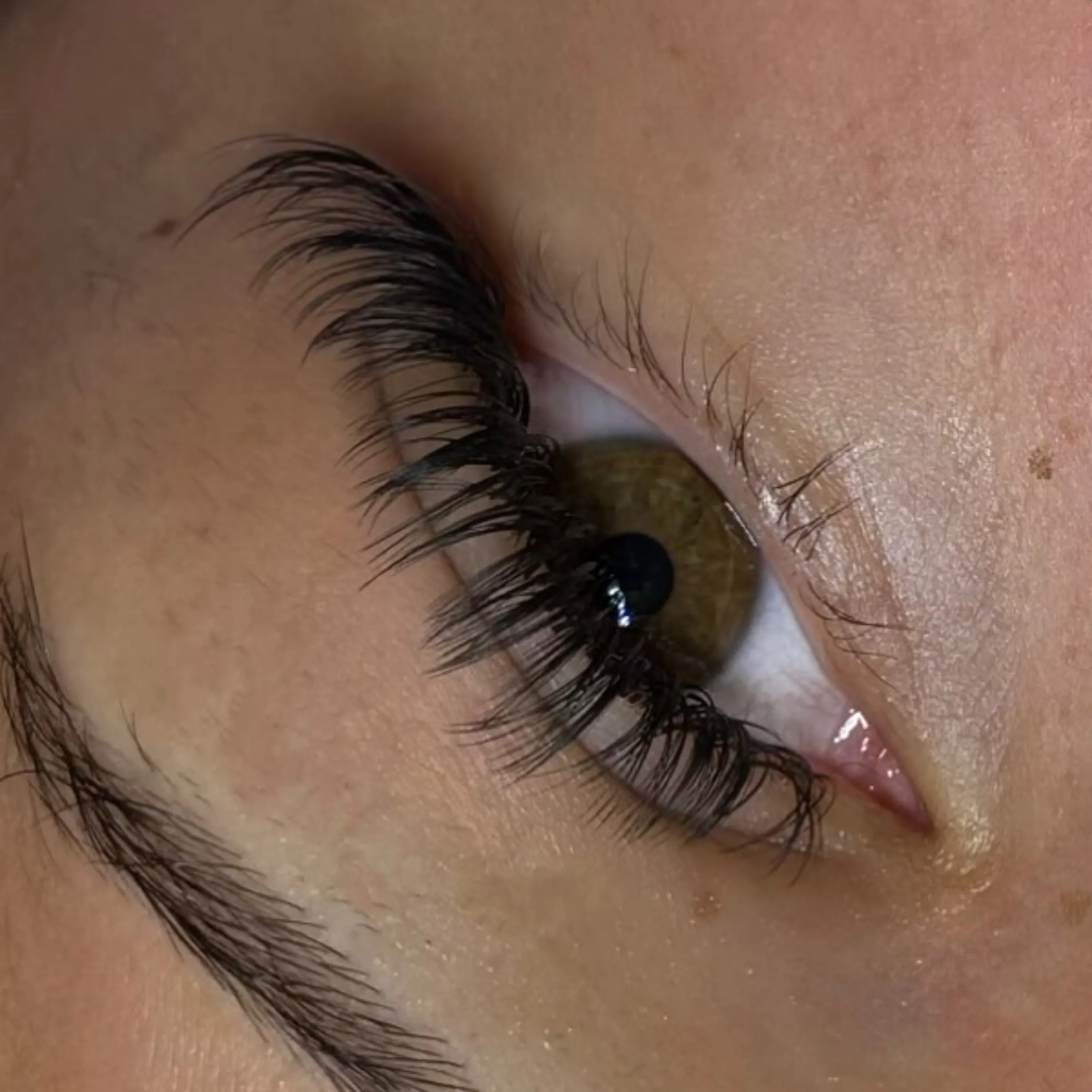 different skin conditions